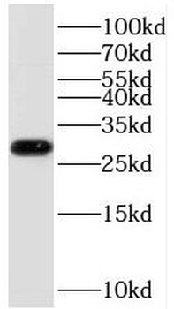 TOLLIP Rabbit Polyclonal Antibody