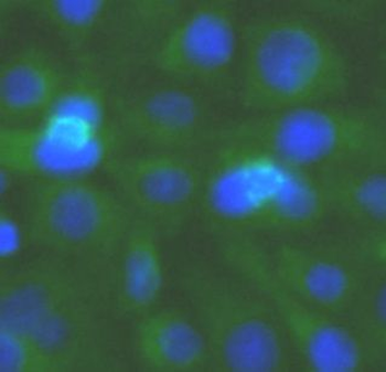 TOLLIP Rabbit Polyclonal Antibody