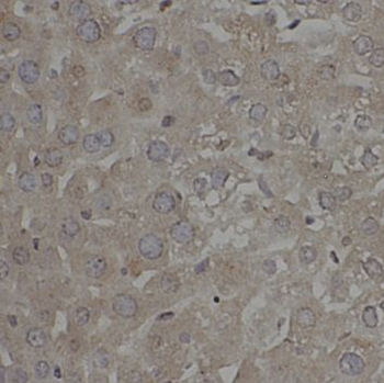 TOLLIP Rabbit Polyclonal Antibody