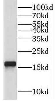UBE2N Rabbit Polyclonal Antibody