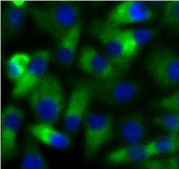 UBE2N Rabbit Polyclonal Antibody
