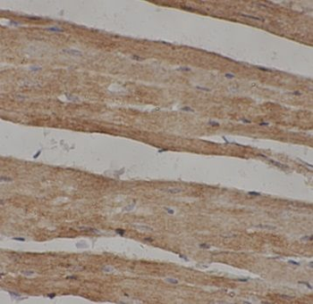 UBE2N Rabbit Polyclonal Antibody