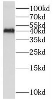 MAPK11 Rabbit Polyclonal Antibody