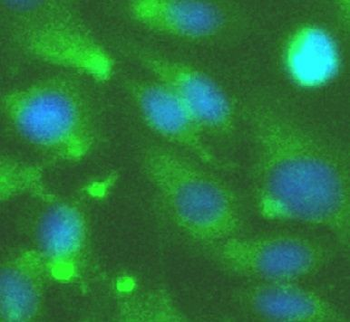 MAPK11 Rabbit Polyclonal Antibody
