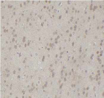 MAPK11 Rabbit Polyclonal Antibody