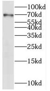 IRAK2 Rabbit Polyclonal Antibody