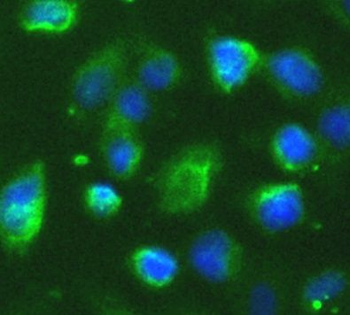 IRAK2 Rabbit Polyclonal Antibody