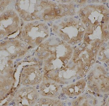 IRAK2 Rabbit Polyclonal Antibody