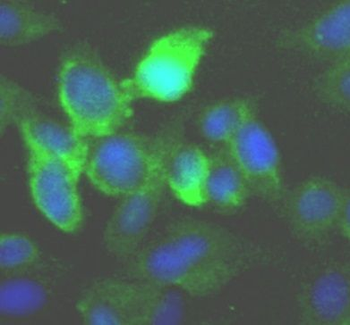 IKBKE Rabbit Polyclonal Antibody