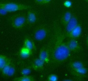 TRAF3 Rabbit Polyclonal Antibody