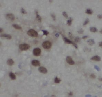 TRAF3 Rabbit Polyclonal Antibody