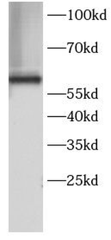 HSPD1 Rabbit Polyclonal Antibody