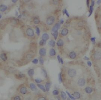 HSPD1 Rabbit Polyclonal Antibody