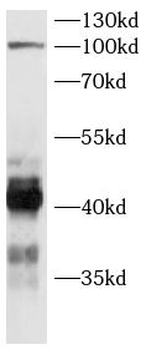 SHARPIN Rabbit Polyclonal Antibody