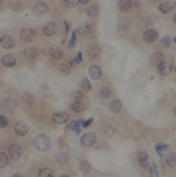 SHARPIN Rabbit Polyclonal Antibody