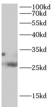 TRADD Rabbit Polyclonal Antibody