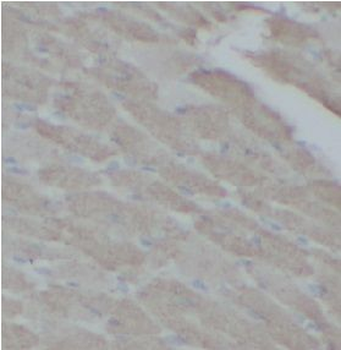 TRADD Rabbit Polyclonal Antibody