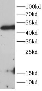 HDAC8 Rabbit Polyclonal Antibody