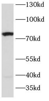 SLC6A4 Rabbit Polyclonal Antibody