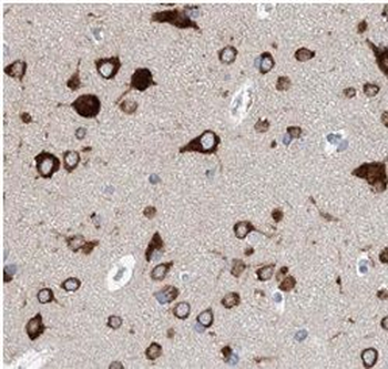 SLC6A4 Rabbit Polyclonal Antibody