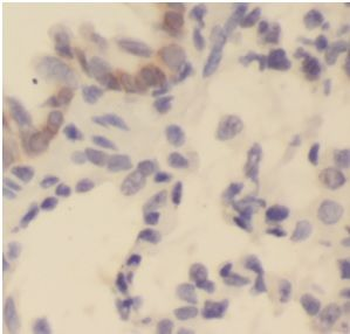 Il1b Rabbit Polyclonal Antibody