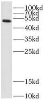 SARS CoV 2 N protein Mouse Monoclonal Antibody