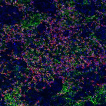 Immune Checkpoint Profiling Antibody Panel