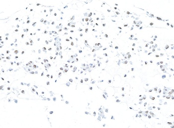 Rabbit MSH2 Recombinant Monoclonal Antibody