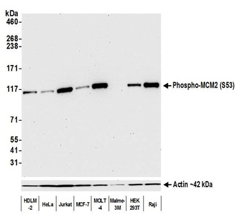 Rabbit Phospho MCM2 (S53) Recombinant Monoclonal Antibody