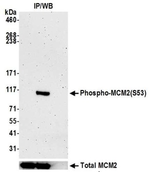 Rabbit Phospho MCM2 (S53) Recombinant Monoclonal Antibody