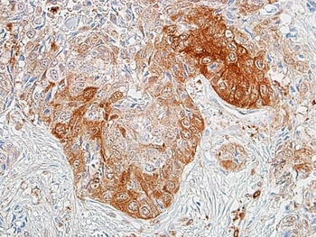 Rabbit ALDH1A1 Recombinant Monoclonal Antibody