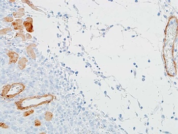 Rabbit alpha Smooth Muscle Actin Recombinant Monoclonal Antibody
