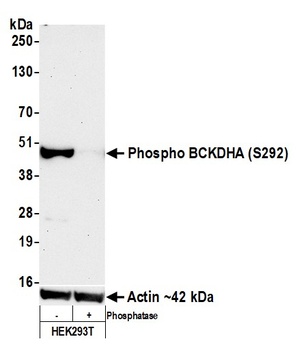 Rabbit Phospho BCKDHA (S292) Recombinant Monoclonal Antibody