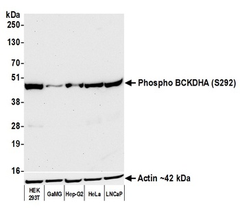 Rabbit Phospho BCKDHA (S292) Recombinant Monoclonal Antibody