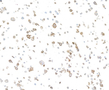Rabbit CD137 Recombinant Monoclonal Antibody