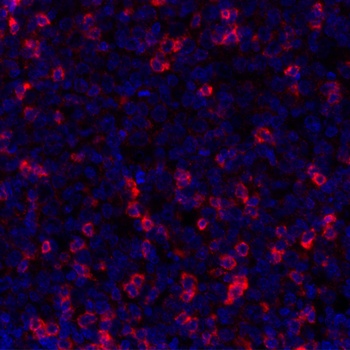 Rabbit TIGIT Recombinant Monoclonal Antibody