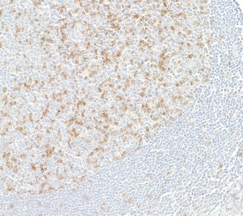 Rabbit TIGIT Recombinant Monoclonal Antibody