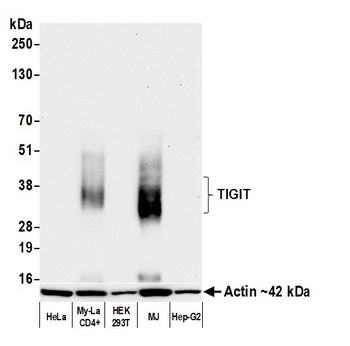Rabbit TIGIT Recombinant Monoclonal Antibody