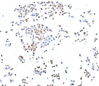 Rabbit CTCF Recombinant Monoclonal Antibody