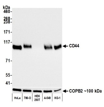 Rabbit CD44 Recombinant Monoclonal Antibody