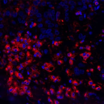 Rabbit VISTA Recombinant Monoclonal Antibody