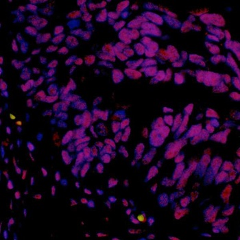 Rabbit hSET1 Recombinant Monoclonal Antibody