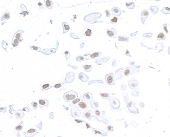 Rabbit SMC1 Recombinant Monoclonal Antibody