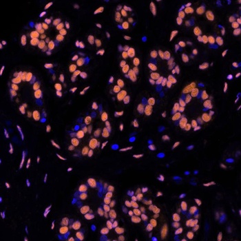 Rabbit SMC1 Recombinant Monoclonal Antibody