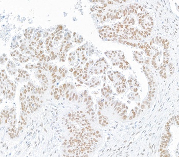 Rabbit SMC1 Recombinant Monoclonal Antibody