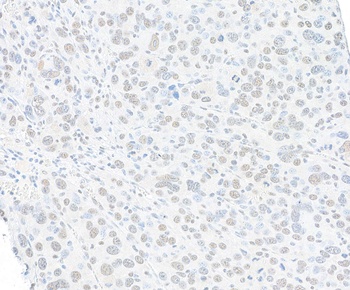 Rabbit SMC1 Recombinant Monoclonal Antibody