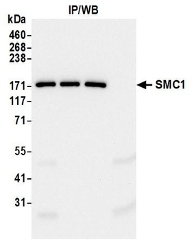 Rabbit SMC1 Recombinant Monoclonal Antibody