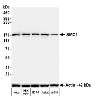 Rabbit SMC1 Recombinant Monoclonal Antibody