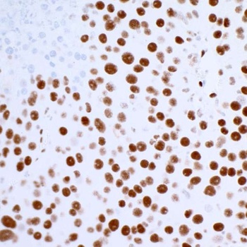 Rabbit 53BP1 Recombinant Monoclonal Antibody