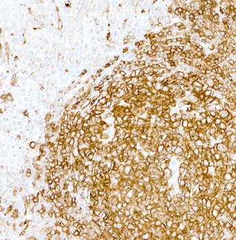 Mouse HLA-DR Monoclonal Antibody